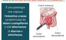  Sindrome del colon irritabile: sintomi, cosa mangiare e rimedi