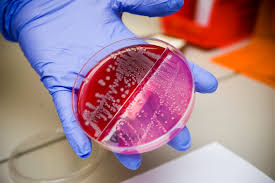 escherichia coli nelle urine 